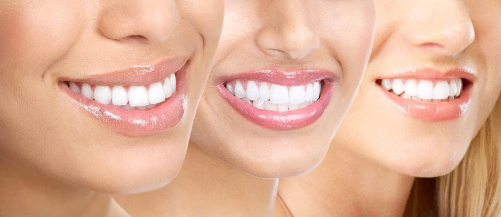 Straightening Teeth with Invisalign and teeth whitening at Aesthetic Dental Studio