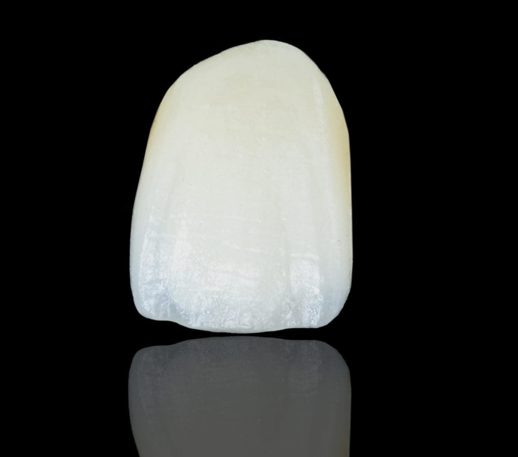 Veneer Porcelain Shell at Aesthetic Dental Studio in Nottingham